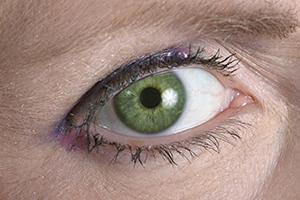 Lutein is believed to be important for eye health.